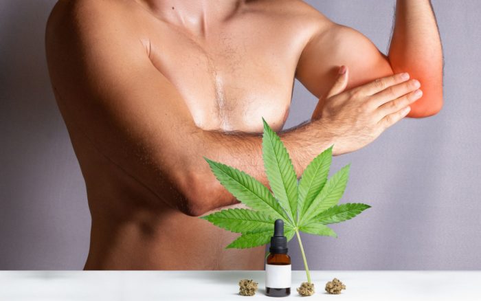 descubre cómo el CBD puede aliviar el dolor y la inflamación en pacientes con fibromialgia